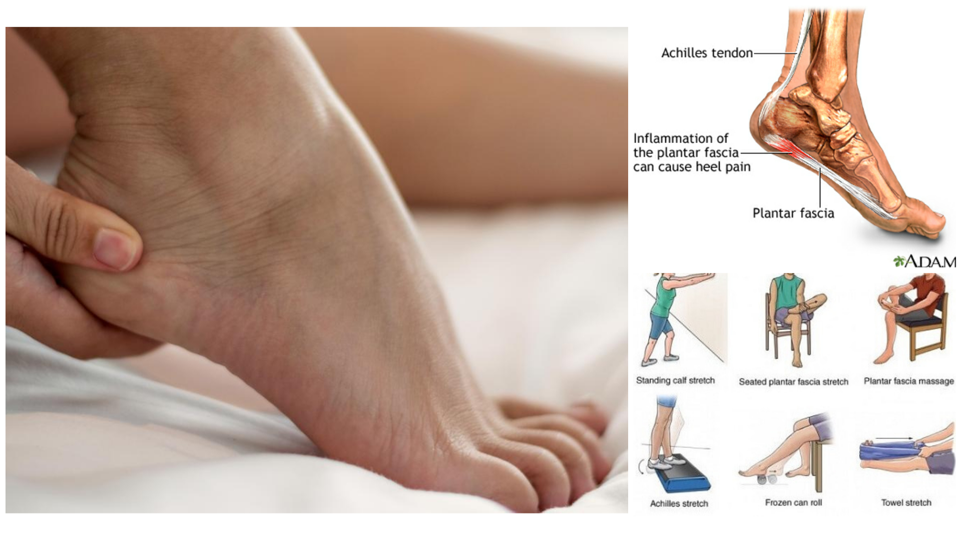 Punca sakit tumit kaki bagi wanita