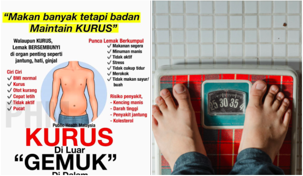 Makan Banyak Tapi Maintain Kurus Rupanya Lemak Tengah Sembunyi