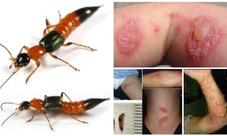 bahaya semut charlie (1)