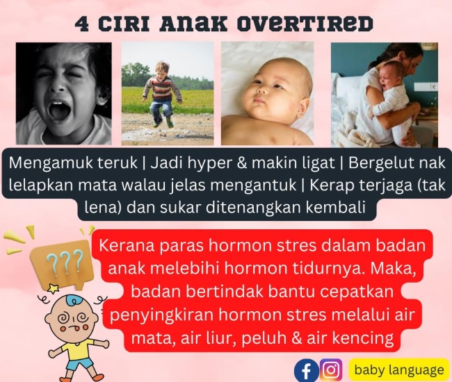 cara menangani bayi overtired