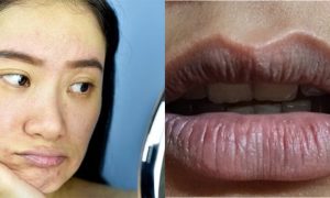bibir hitam