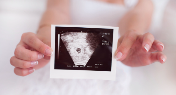 trimester pertama kehamilan