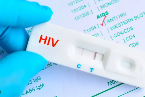 ujian saringan hiv