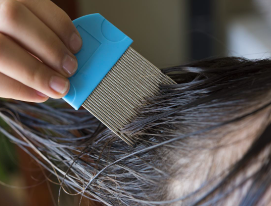 cara hilangkan kutu rambut