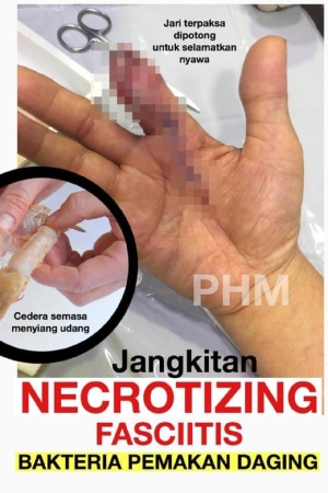 siang udang