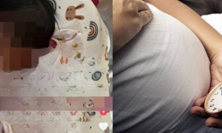 bayi kurang gerak