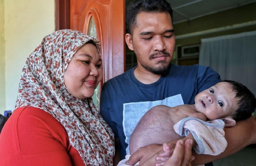 perut besar