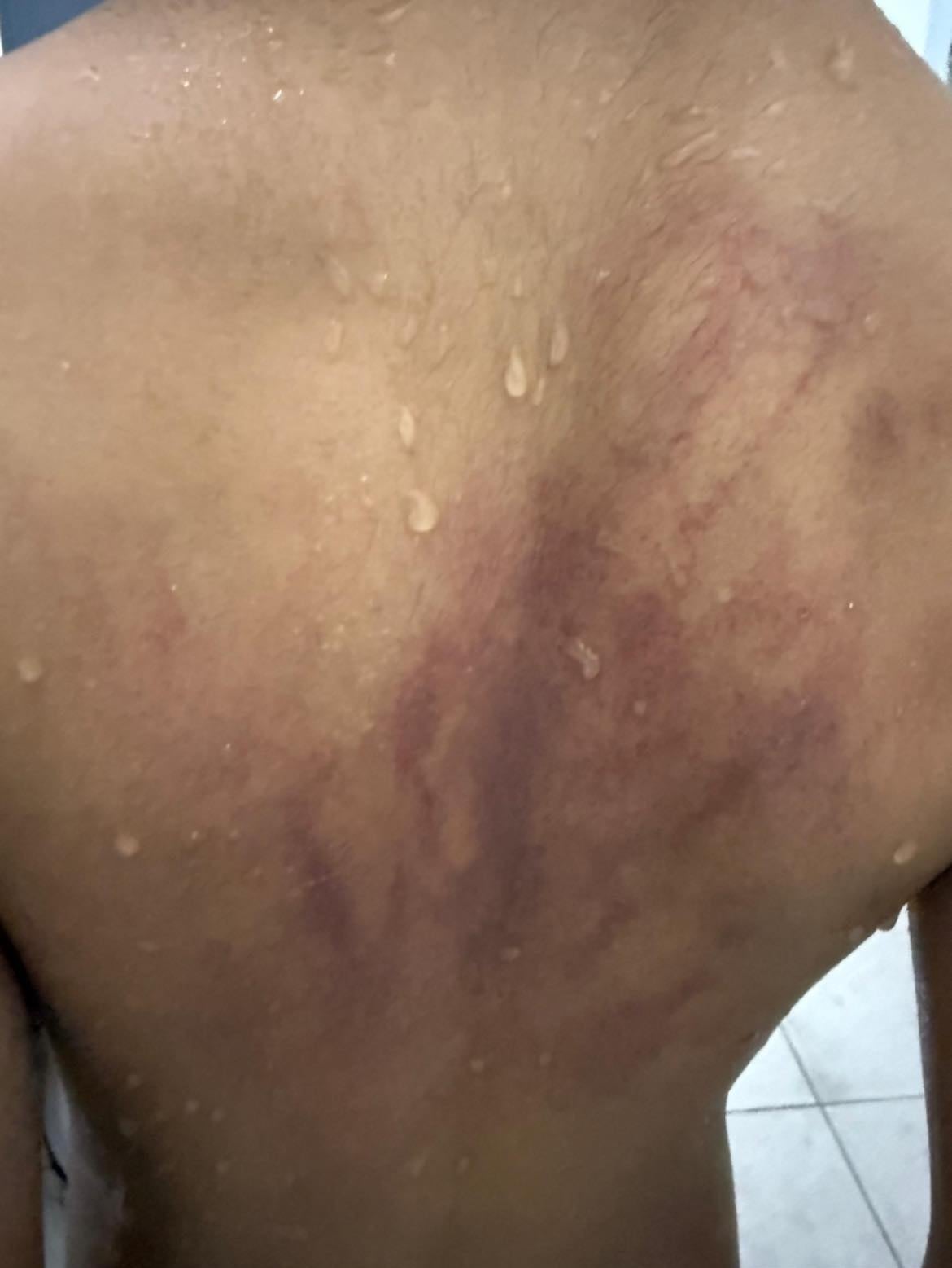 ANAK AUTISME KENA DERA