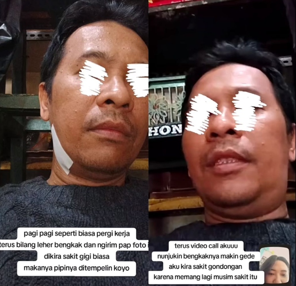 sakit gigi 