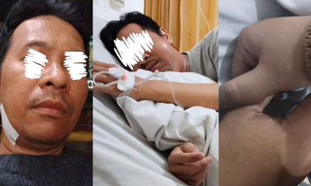 sakit gigi