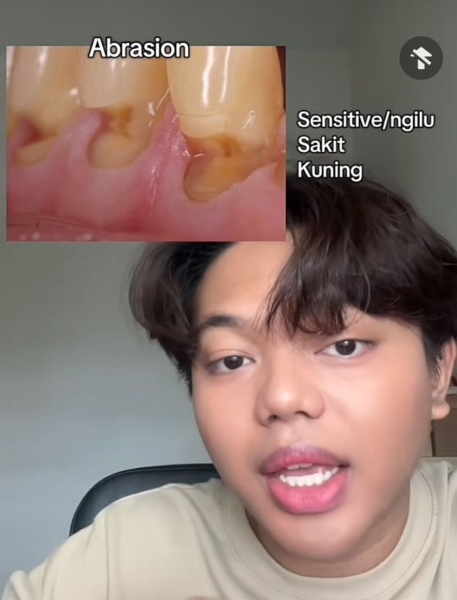 cara gosok gigi yang betul