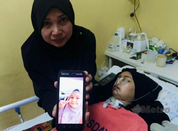 tumor otak