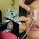 tumor otak
