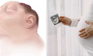bentuk kepala bayi