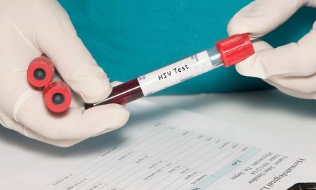 kes jangkitan hiv