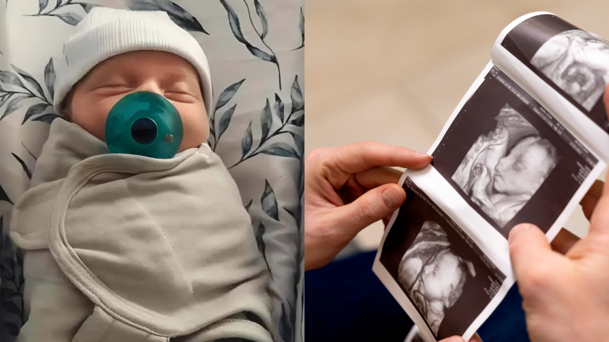 bayi lelaki hasil embrio
