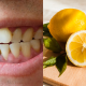 CARA HILANGKAN KARANG GIGI
