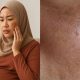 kulit hitam