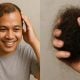 petua rambut banyak gugur