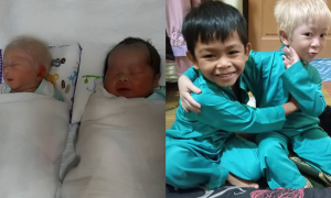 anak kembar