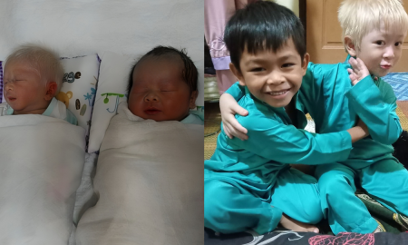 anak kembar