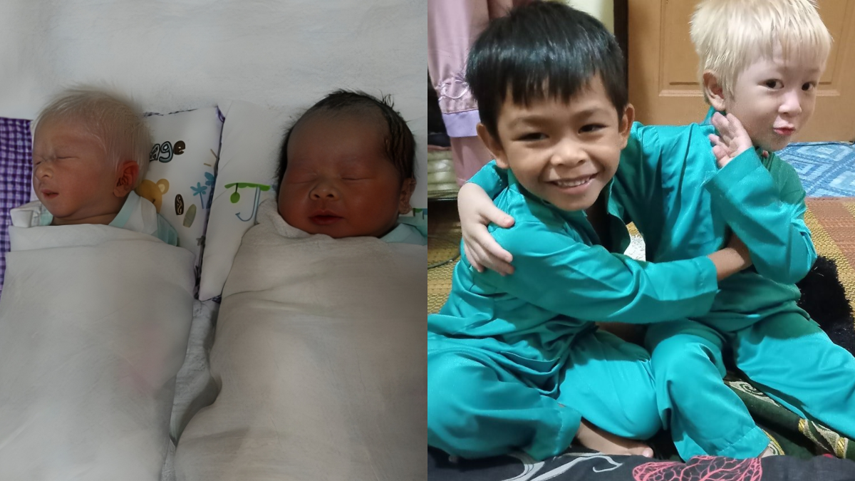 anak kembar