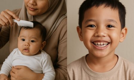 gigi jarang