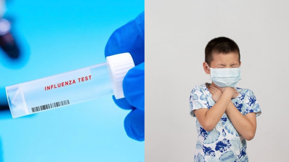 influenza A