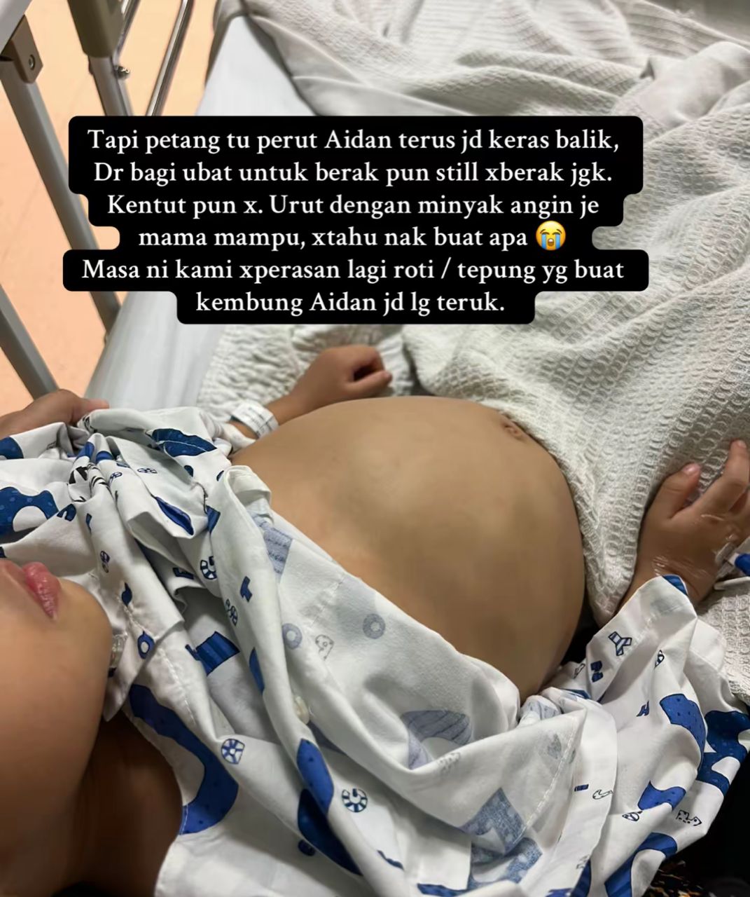PERUT KEMBUNG