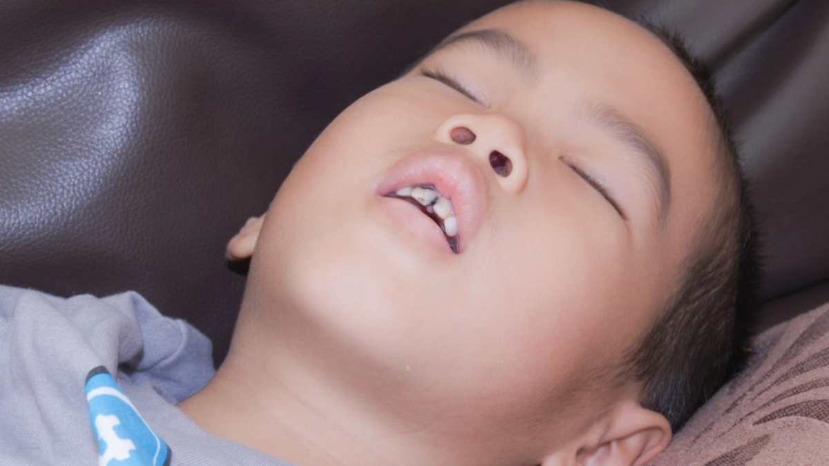 tidur mulut terbuka