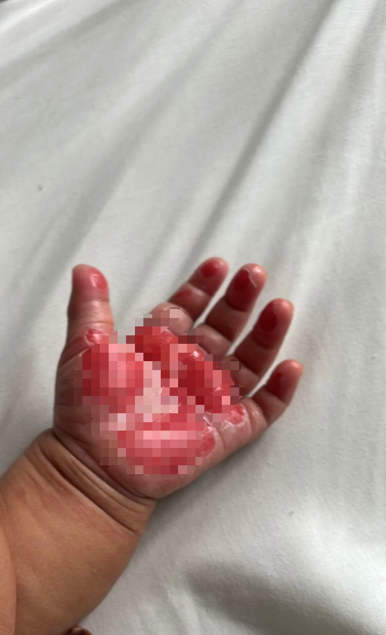 TANGAN ANAK MELECUR