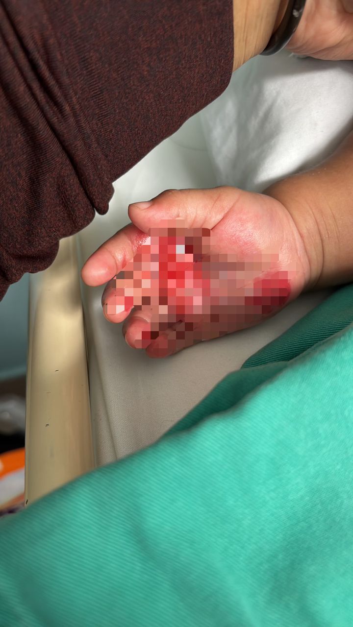 TANGAN ANAK MELECUR