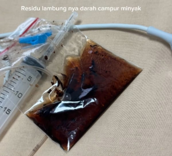 bayi cirit-birit