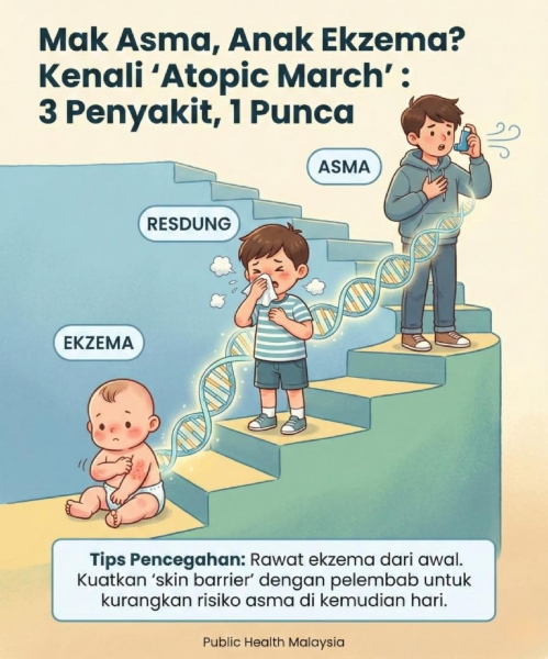 anak ekzema