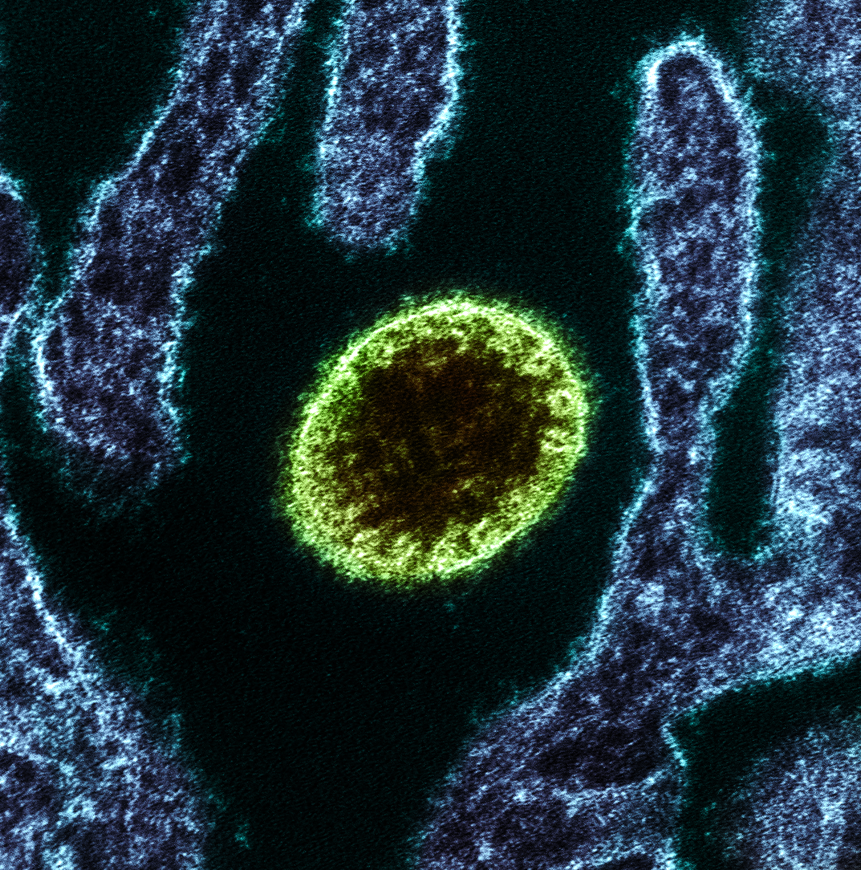NIPAH VIRUS