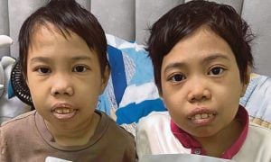 penyakit genetik
