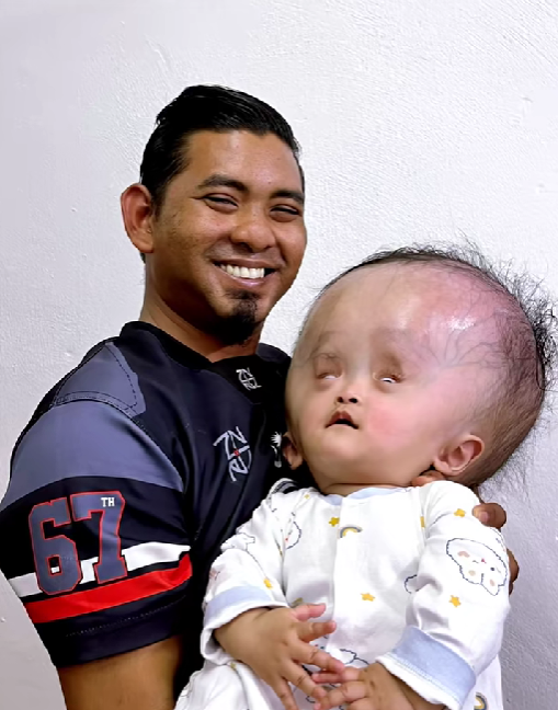 berat kepala
