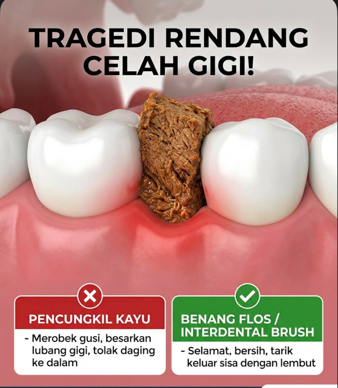 celah gigi