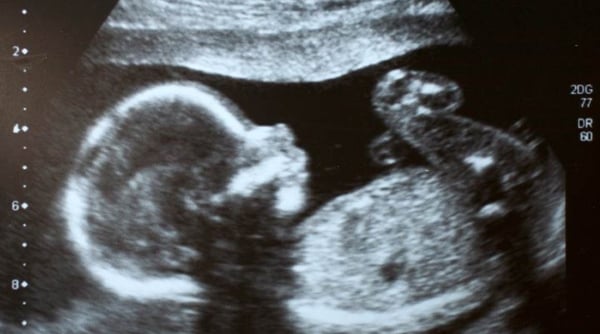 bayi ekspres