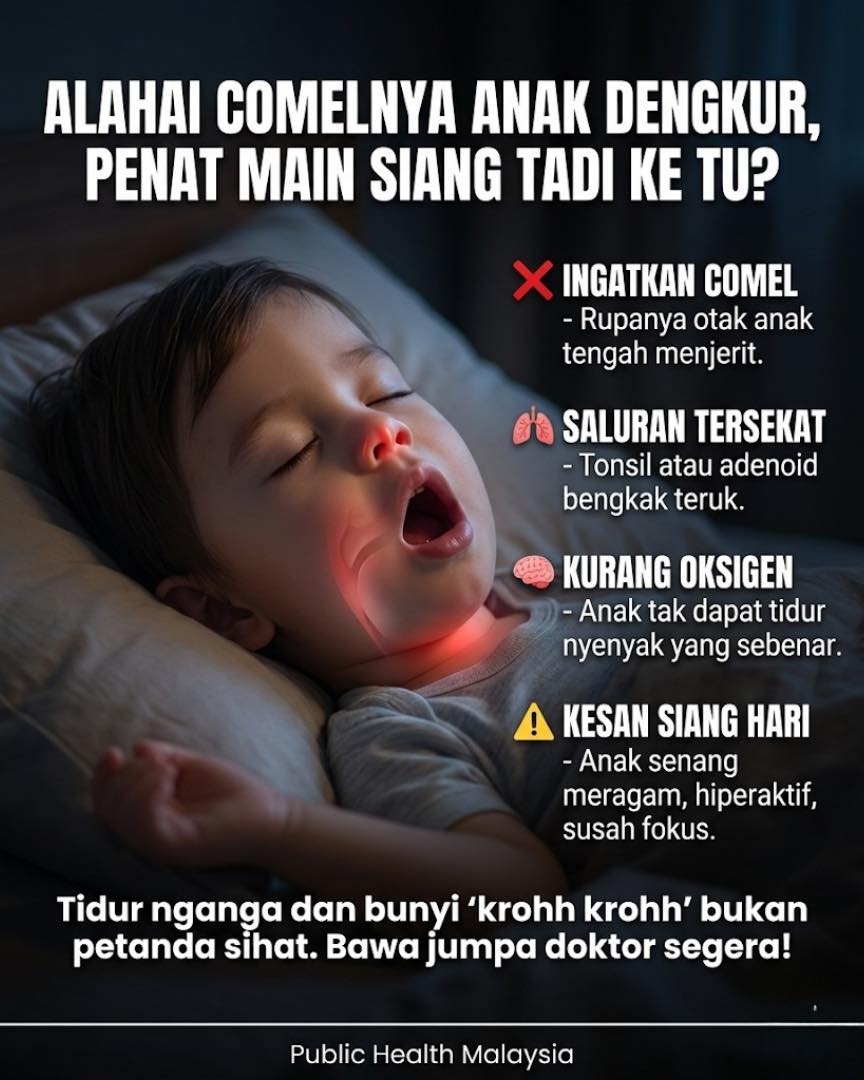 tidur berdengkur