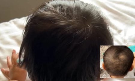 rambut lebat