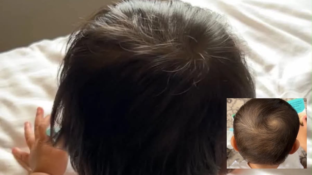 rambut lebat