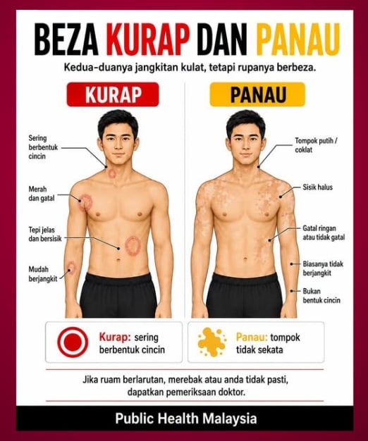 jangkitan kulat