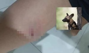 DIGIGIT ANJING LIAR