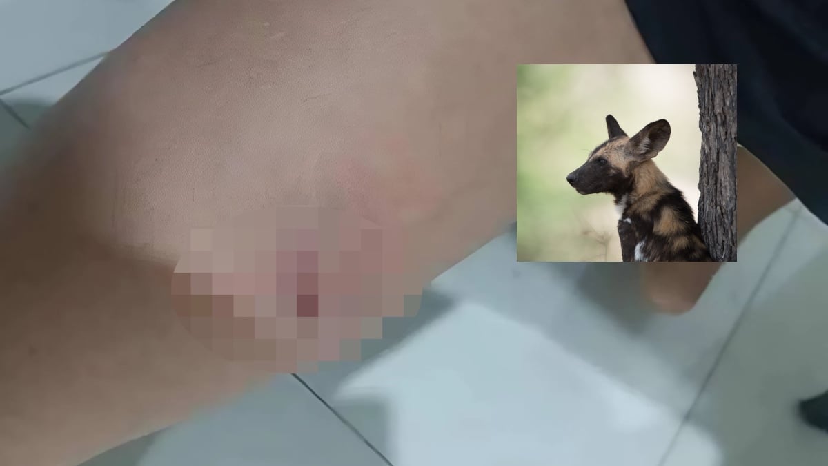DIGIGIT ANJING LIAR