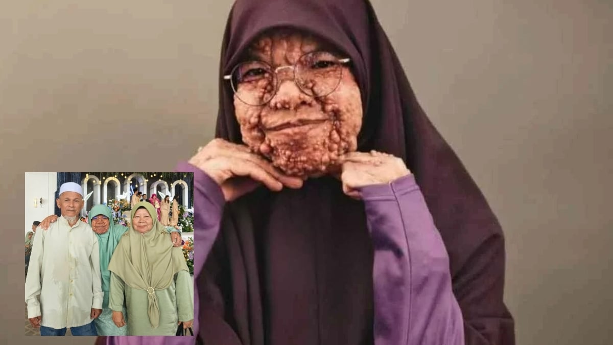 kulit berbiji