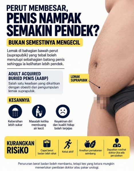 perut membesar