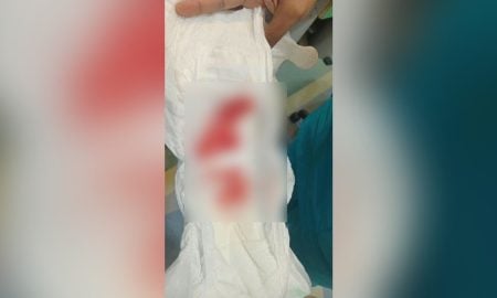 NAJIS BERDARAH
