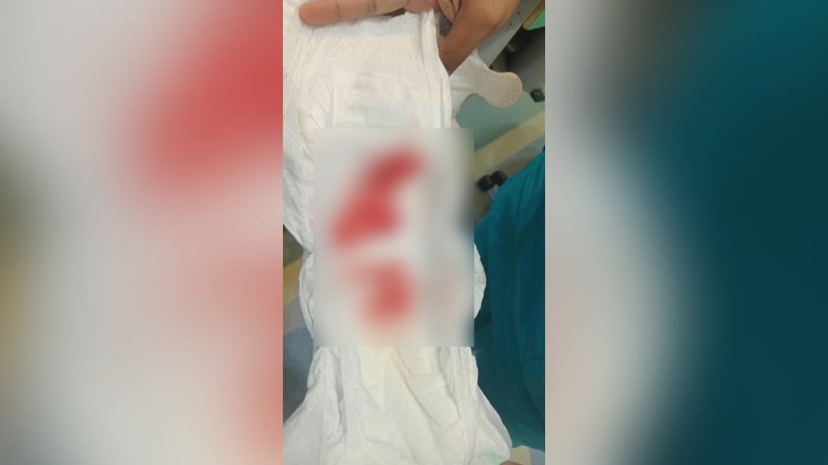 NAJIS BERDARAH