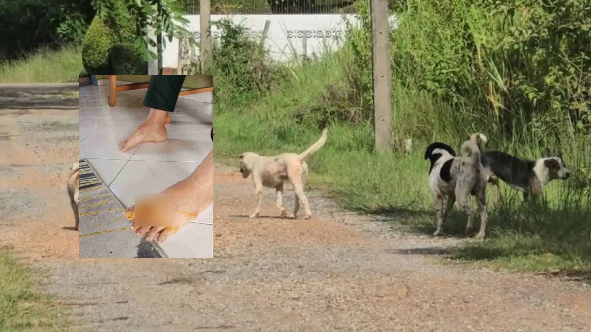 SERANGAN ANJING LIAR
